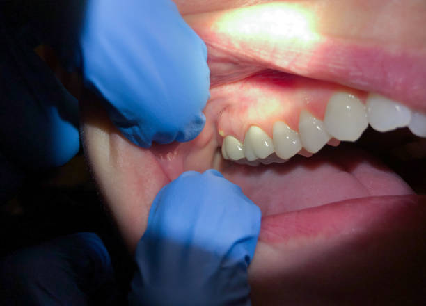 Best Urgent Dental Care for Toothache in Jacksonvle, IL