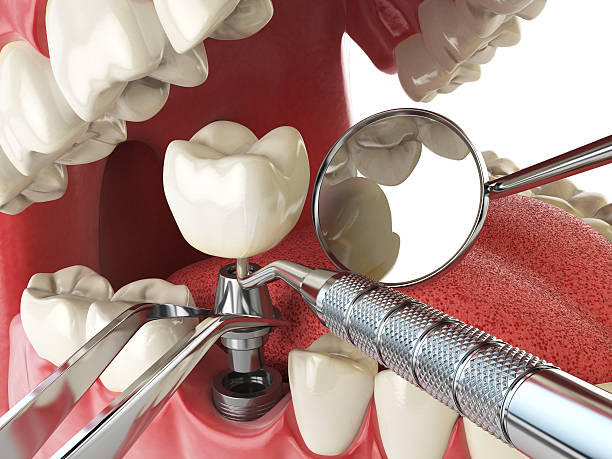 Best Emergency Dentist for Special Needs Patients in Jacksonvle, IL